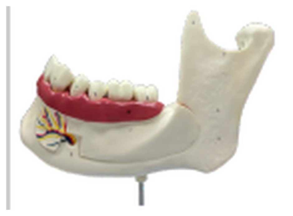 Modelo de Anatomia do Dente e Mandíbula Inferior de um Jovem (18 anos), em 6 Partes