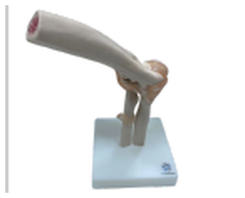 Modelo de Articulação do Cotovelo com Ligamentos em Tamanho Real