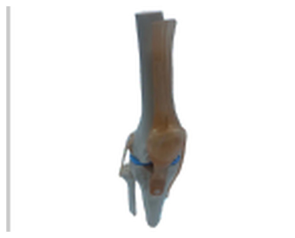 Modelo de Articulação do Joelho, com Ligamentos em Tamanho Real