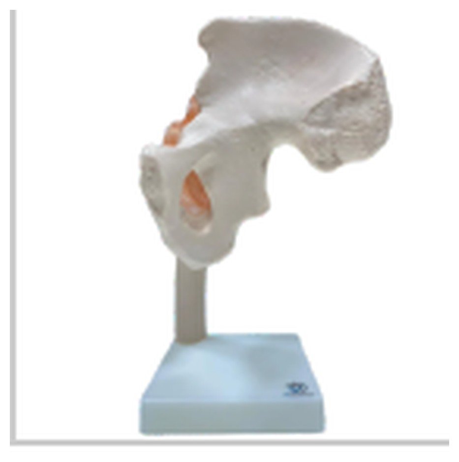 Modelo de Articulação do Quadril com Ligamentos